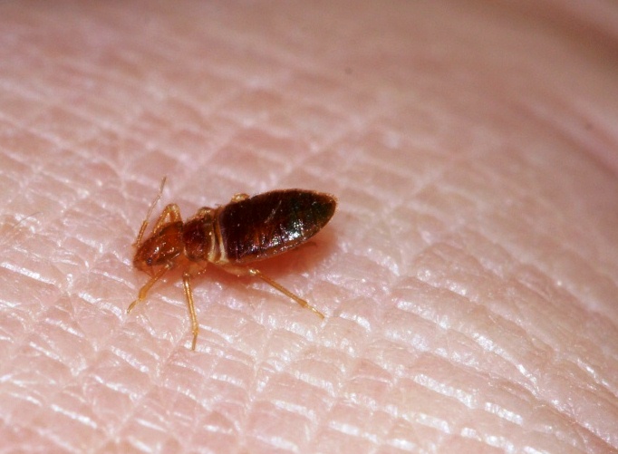 Bedbugs Photos : Bed Bugs On Humans